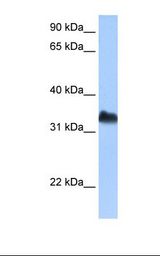 Jurkat cell lysate. Antibody concentration: 0.5 ug/ml. Gel concentration: 12%.