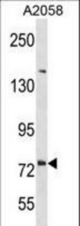 DNER Antibody western blot of A2058 cell line lysates (35 ug/lane). The DNER antibody detected the DNER protein (arrow).
