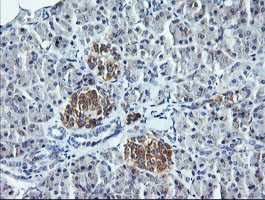 IHC of paraffin-embedded Human pancreas tissue using anti-DNM1L mouse monoclonal antibody. (Heat-induced epitope retrieval by 10mM citric buffer, pH6.0, 120°C for 3min).