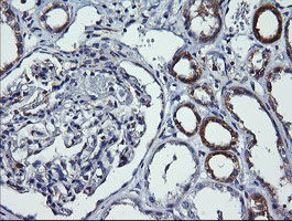 IHC of paraffin-embedded Human Kidney tissue using anti-DNM1L mouse monoclonal antibody. (Heat-induced epitope retrieval by 10mM citric buffer, pH6.0, 120°C for 3min).