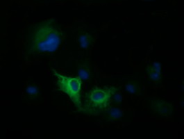 Anti-DNM1L mouse monoclonal antibody immunofluorescent staining of COS7 cells transiently transfected by pCMV6-ENTRY DNM1L.