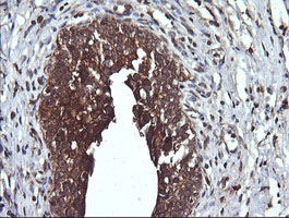 IHC of paraffin-embedded Human bladder tissue using anti-DNM1L mouse monoclonal antibody.