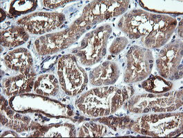 IHC of paraffin-embedded Human Kidney tissue using anti-DNM1L mouse monoclonal antibody.