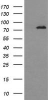 HEK293T cells were transfected with the pCMV6-ENTRY control (Left lane) or pCMV6-ENTRY DNM1L (Right lane) cDNA for 48 hrs and lysed. Equivalent amounts of cell lysates (5 ug per lane) were separated by SDS-PAGE and immunoblotted with anti-DNM1L.