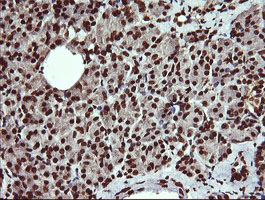 IHC of paraffin-embedded Human pancreas tissue using anti-DNM1L mouse monoclonal antibody.