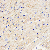 Immunohistochemistry of paraffin-embedded mouse heart using CHI3L1 antibody at dilution of 1:200 (x400 lens)