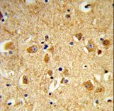 Formalin-fixed and paraffin-embedded human brain tissue reacted with DNM3 Antibody , which was peroxidase-conjugated to the secondary antibody, followed by DAB staining. This data demonstrates the use of this antibody for immunohistochemistry; clinical relevance has not been evaluated.