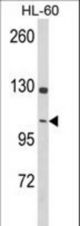 Western blot of DNM3 Antibody in HL-60 cell line lysates (35 ug/lane). DNM3 (arrow) was detected using the purified antibody.