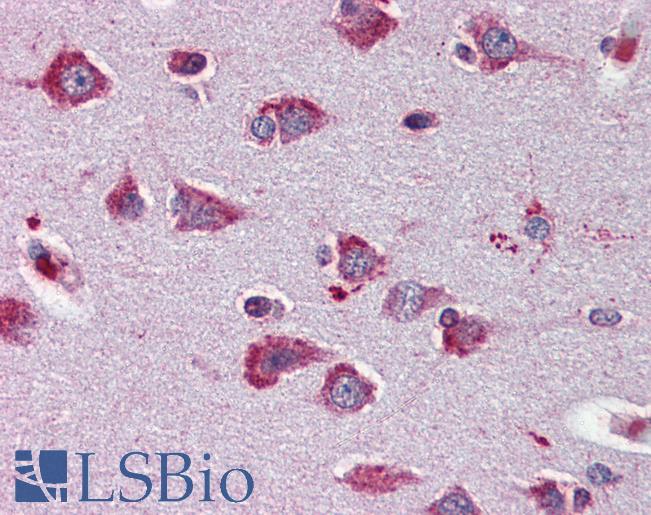 Anti-DNM3 / Dynamin-3 antibody IHC of human brain, cortex. Immunohistochemistry of formalin-fixed, paraffin-embedded tissue after heat-induced antigen retrieval. Antibody LS-B2880 dilution 1:100.