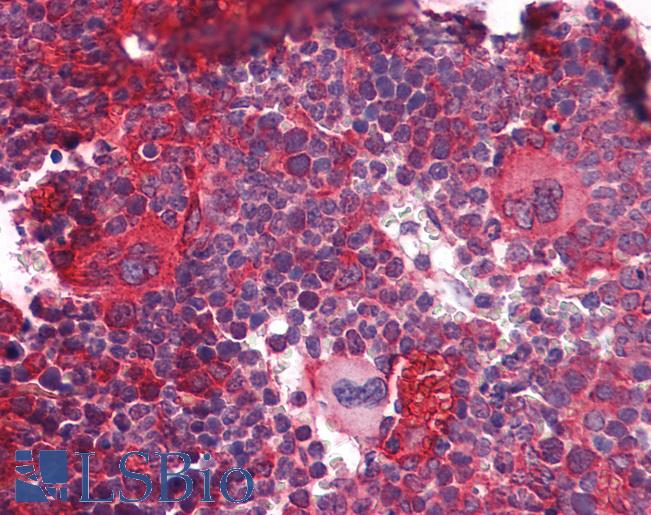 Anti-DNMT1 antibody IHC of mouse lymphoid tissue. Immunohistochemistry of formalin-fixed, paraffin-embedded tissue after heat-induced antigen retrieval. Antibody LS-B5632 concentration 5 ug/ml.