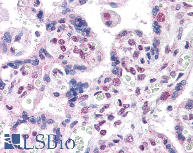 Anti-DNMT1 antibody IHC of human placenta. Immunohistochemistry of formalin-fixed, paraffin-embedded tissue after heat-induced antigen retrieval. Antibody LS-B4353 concentration 3.75 ug/ml.