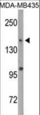 Western blot of DNMT1 Antibody (S1105) in MDA-MB435 cell line lysates (35 ug/lane). DNMT1 (arrow) was detected using the purified antibody.