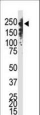 The anti-Dnmt1 C-term antibody is used in Western blot to detect Dnmt1 in Jurkat cell lysate.