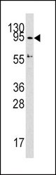 Western blot of DNMT3A Antibody in HepG2 cell line lysates (35 ug/lane). DNMT3A (arrow) was detected using the purified antibody.