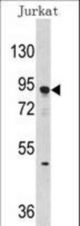 Western blot of anti-DNMT3A Antibody (Center D472) in Jurkat cell line lysates (35 ug/lane). DNMT3A(arrow) was detected using the purified antibody.