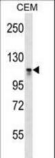 DNMT3A Antibody (C-term V897) western blot of CEM cell line lysates (35 ug/lane). The DNMT3A antibody detected the DNMT3A protein (arrow).