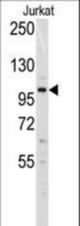 Western blot of anti-Dnmt3a Antibody (N-term R46) in Jurkat cell line lysates (35 ug/lane). Dnmt3a(arrow) was detected using the purified antibody.