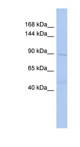 DNMT3B antibody LS-C111224 Western blot of OVCAR-3 cell lysate.