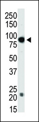 Western blot of anti-Dnmt3b antibody in T47-D cell lysate. Dnmt3b (arrow) was detected using purified antibody. Secondary HRP-anti-rabbit was used for signal visualization with chemiluminescence.