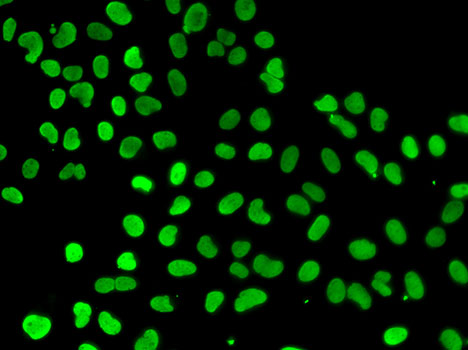 Immunofluorescence analysis of A549 cell using DNMT3L antibody.