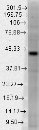Western blot analysis of DNMT3L in a human tissue mix using a 1:1000 dilution of DNMT3L antibody.
