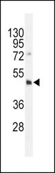 Dnmt3L-R322 western blot of HL-60 cell line lysates (35 ug/lane). The DNMT3L antibody detected the DNMT3L protein (arrow).
