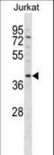 DNMT3L Antibody western blot of Jurkat cell line lysates (35 ug/lane). The DNMT3L antibody detected the DNMT3L protein (arrow).