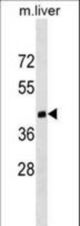 Dnmt3l Antibody (C403) western blot of mouse liver tissue lysates (35 ug/lane). The Dnmt3l antibody detected the Dnmt3l protein (arrow).