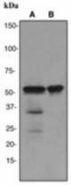 Western blot analysis on (A) human thymus and (B) Jurkat lysates using anti-TDT antibody (LS-C105441), dilution 1:10000.