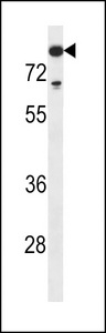TdT Antibody western blot of MDA-MB453 cell line lysates (35 ug/lane). The TdT antibody detected the TdT protein (arrow).