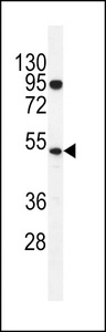 TdT Antibody western blot of K562 cell line lysates (35 ug/lane). The TdT antibody detected the TdT protein (arrow).