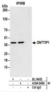 Detection of Human DNTTIP1 by Western Blot of Immunoprecipitates. Samples: Whole cell lysate (1 mg for IP; 20% of IP loaded) from HeLa cells. Antibodies: Affinity purified rabbit anti-DNTTIP1 antibody used for IP at 6 ug/mg lysate. DNTTIP1 was also immunoprecipitated by rabbit anti-DNTTIP1 antibody BL14653. For blotting immunoprecipitated DNTTIP1, was used at 1 ug/ml. Detection: Chemiluminescence with an exposure time of 30 seconds.