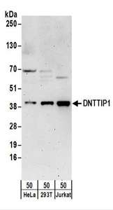 Detection of Human DNTTIP1 by Western Blot. Samples: Whole cell lysate (50 ug) from HeLa, 293T, and Jurkat cells. Antibodies: Affinity purified rabbit anti-DNTTIP1 antibody used for WB at 0.1 ug/ml. Detection: Chemiluminescence with an exposure time of 3 minutes.