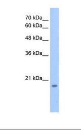 HepG2 cell lysate. Antibody concentration: 2.5 ug/ml. Gel concentration: 12%.