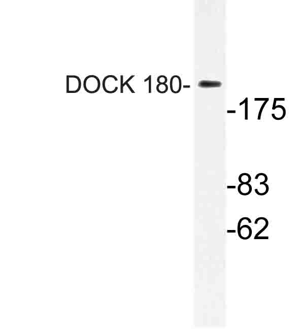 Western blot of DOCK 180 (K1692) pAb in extracts from HUVEC cells.