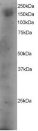 Antibody staining (4 ug/ml) of A431 lysate (RIPA buffer, 35 ug total protein per lane). Primary incubated for 12 hour. Detected by Western blot of chemiluminescence.