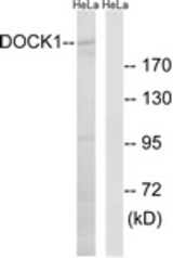 Western blot of extracts from HeLa cells, using DOCK1 Antibody. The lane on the right is treated with the synthesized peptide.
