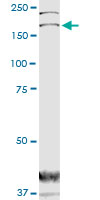 DOCK1 monoclonal antibody (M02), clone 3D10. Western Blot analysis of DOCK1 expression in human colon.