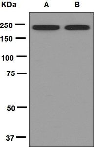 Western blot analysis on (A) Jurkat and (B) Raji cell lysates using anti-DOCK2 antibody.