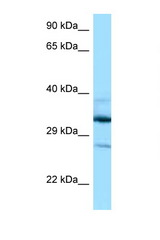 DOHH antibody LS-C146153 Western blot of 435S Cell lysate. Antibody concentration 1 ug/ml.