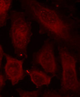 Immunofluorescence staining of methanol-fixed HeLa cells using Phospho-DOK2-Tyr299 antibody.