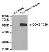 Western blot analysis of extracts from Jurkat cells using Phospho-DOK2-Tyr299 antibody.