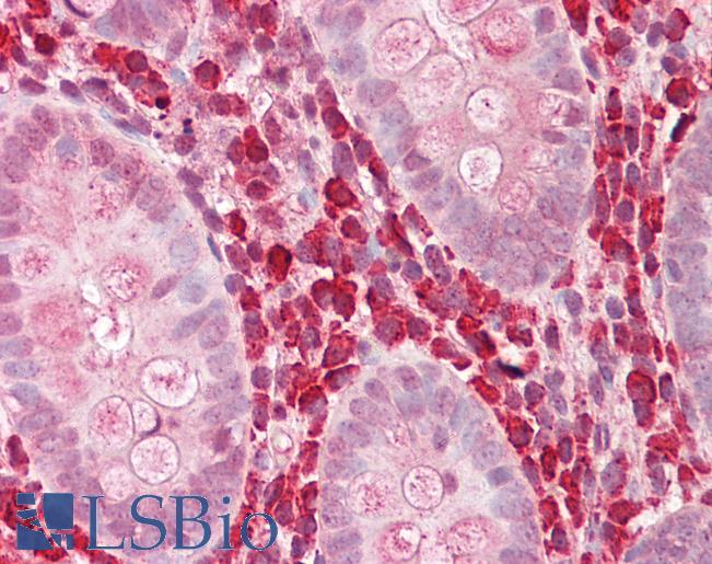 Anti-YKL-40 / CHI3L1 antibody IHC of human colon. Immunohistochemistry of formalin-fixed, paraffin-embedded tissue after heat-induced antigen retrieval. Antibody LS-B8213 dilution 2.5-5 ug/ml.