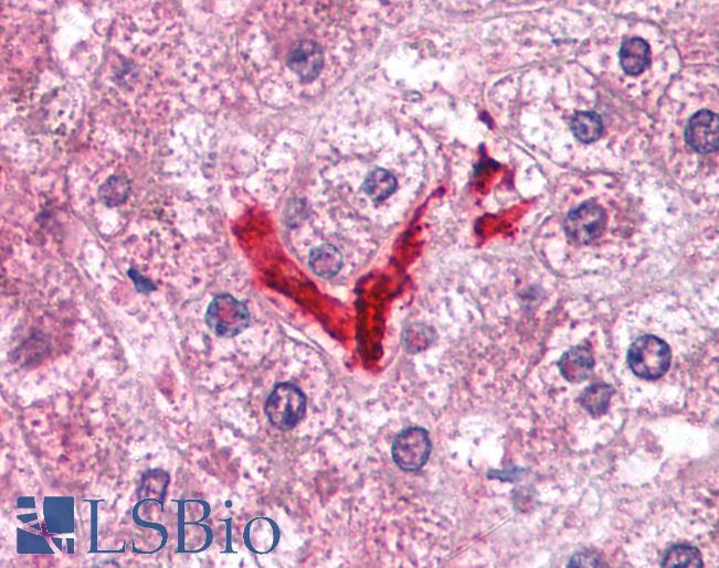 Anti-DOK2 antibody IHC of human liver, Kupffer cells. Immunohistochemistry of formalin-fixed, paraffin-embedded tissue after heat-induced antigen retrieval. Antibody LS-B1520 concentration 5 ug/ml.