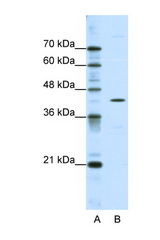 DOK2 antibody LS-B1520 Western blot of HepG2 Cell lysate. Antibody concentration 1 ug/ml.