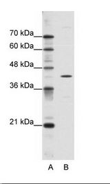 A: Marker, B: HepG2 Cell Lysate