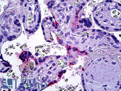Anti-DOK3 antibody IHC of human placenta. Immunohistochemistry of formalin-fixed, paraffin-embedded tissue after heat-induced antigen retrieval. Antibody LS-B5699 concentration 6.125 ug/ml.