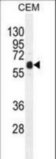 DOK3 Antibody western blot of CEM cell line lysates (35 ug/lane). The DOK3 antibody detected the DOK3 protein (arrow).