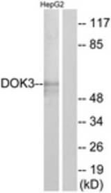 Western blot of extracts from HepG2 cells, using DOK3 Antibody. The lane on the right is treated with the synthesized peptide.