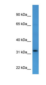 DOK4 antibody LS-C135748 Western blot of Fetal Heart lysate.